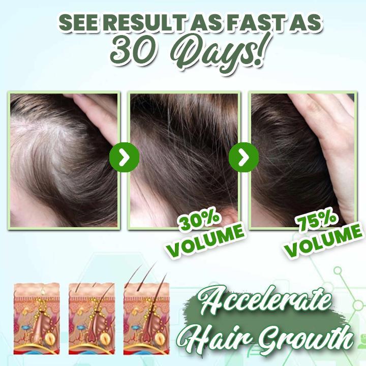 Hair Growth™ | Natürliches Kräuter-Haarspray