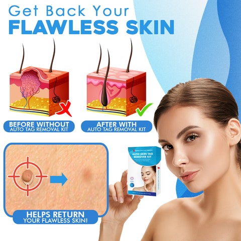 Skinsublime™ | Hauttag-Entferner