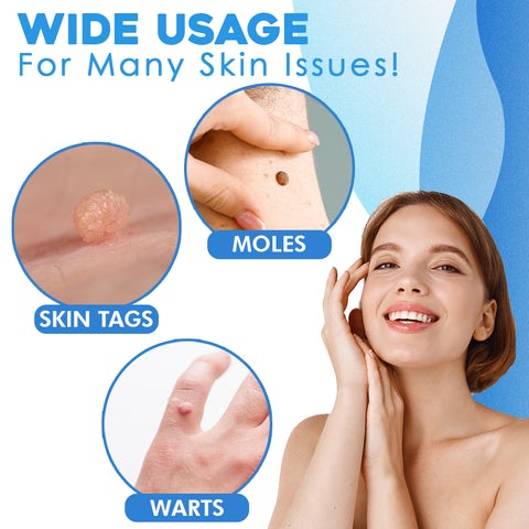 Skinsublime™ | Hauttag-Entferner